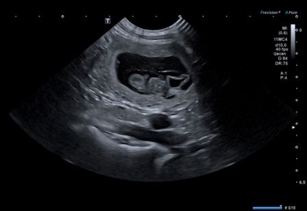 Confirmation de Gestation pour Taïga